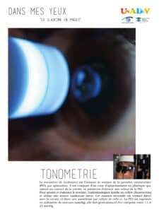 01-tonometrie